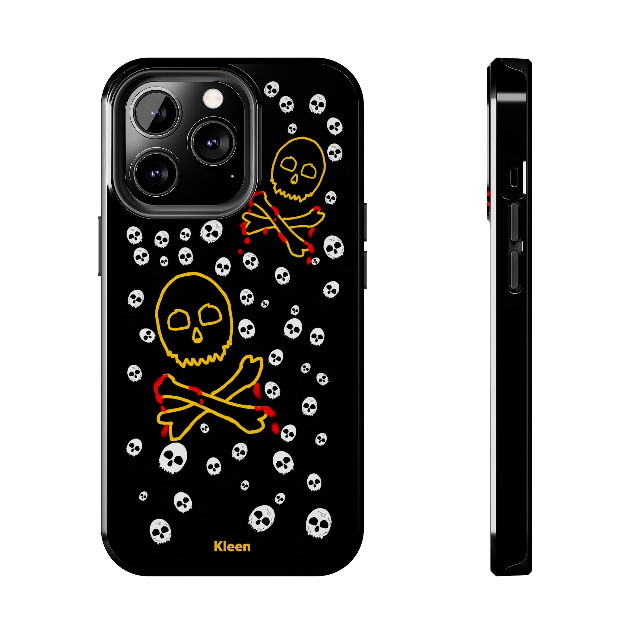 Skeletal